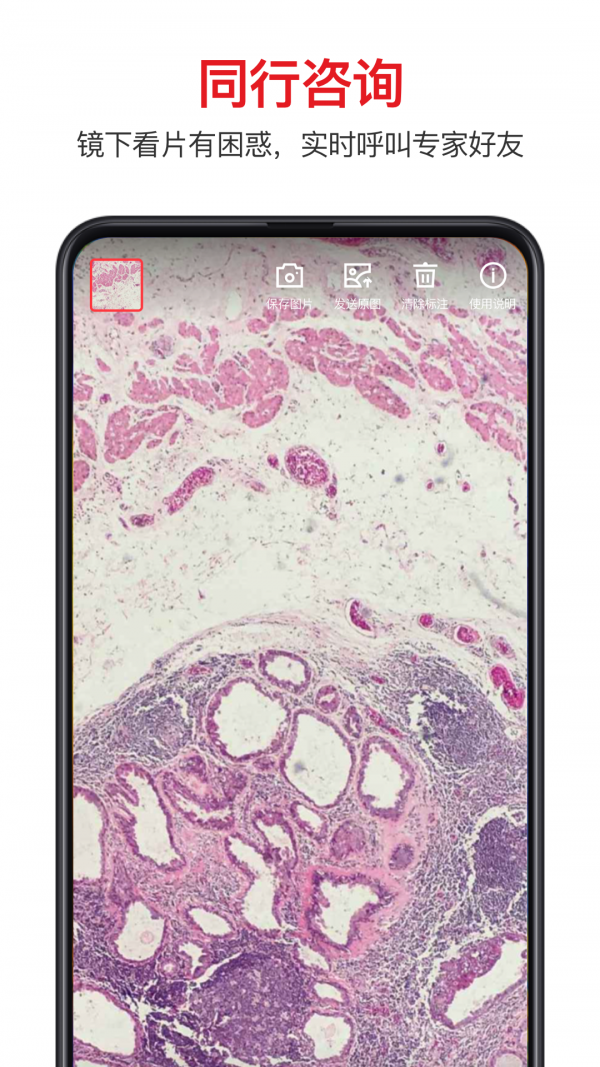 爱病理 3.4.8截图5 爱病理 3.4.8截图5