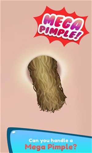 Mega Pimple Popper 1.0.0截图2