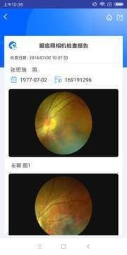 KJ眼底相机截图4