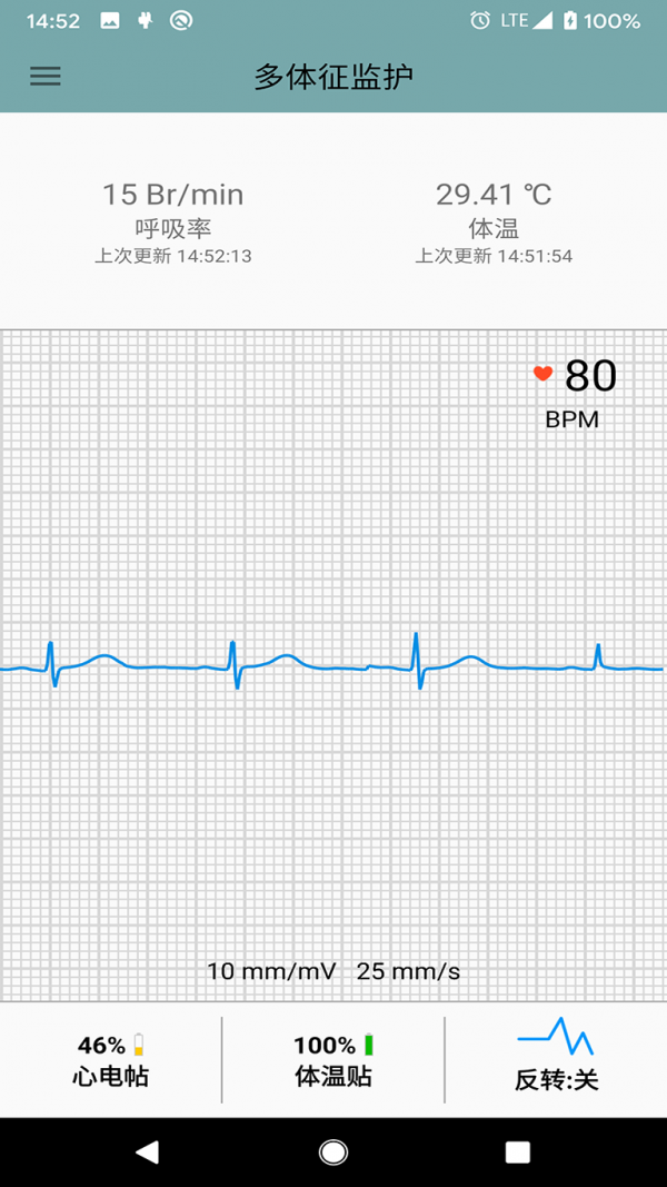 多体征监护截图1